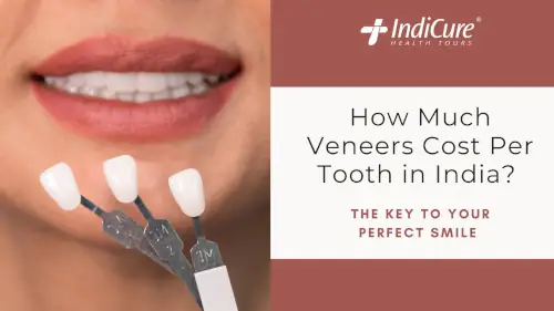 How Much Veneers Cost Per Tooth in India